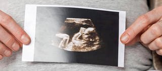 Eine schwangere Frau hält ein Ultraschallbild, das einen Embryo zeigt, vor ihren Bauch